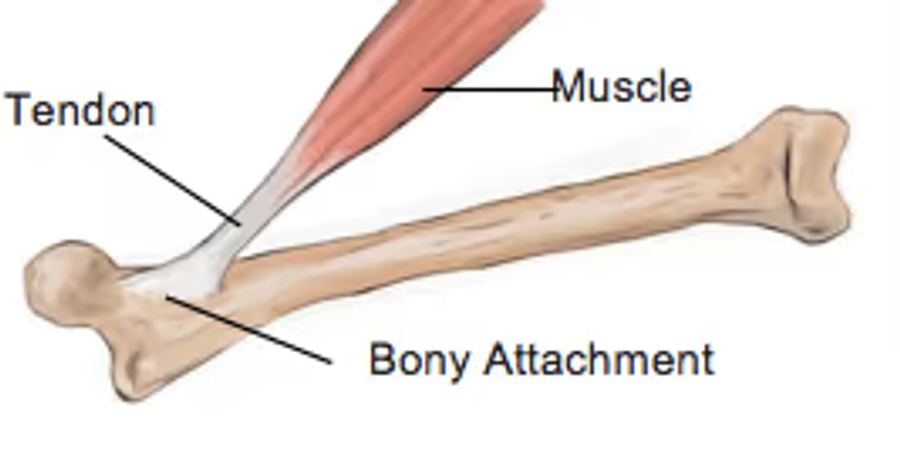 tendon injury