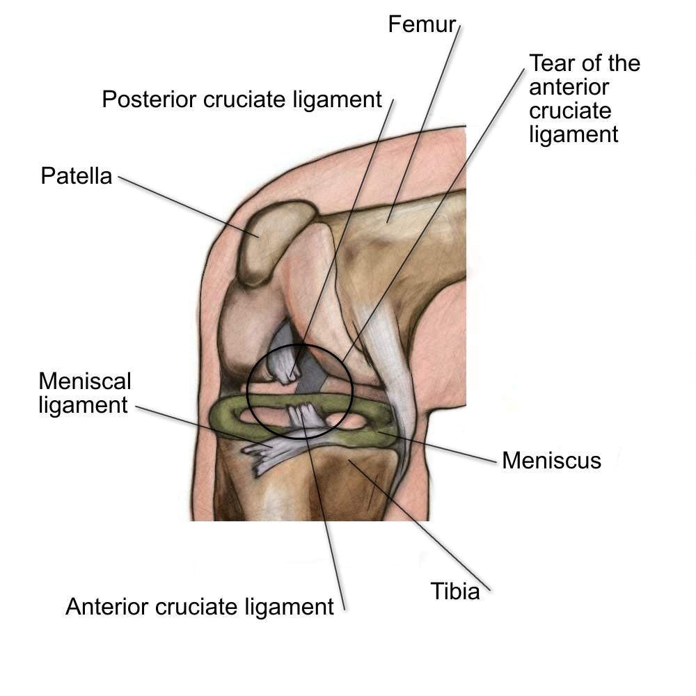 Knee joint