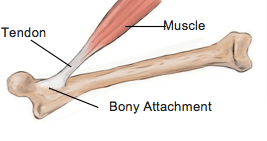 tendon injury